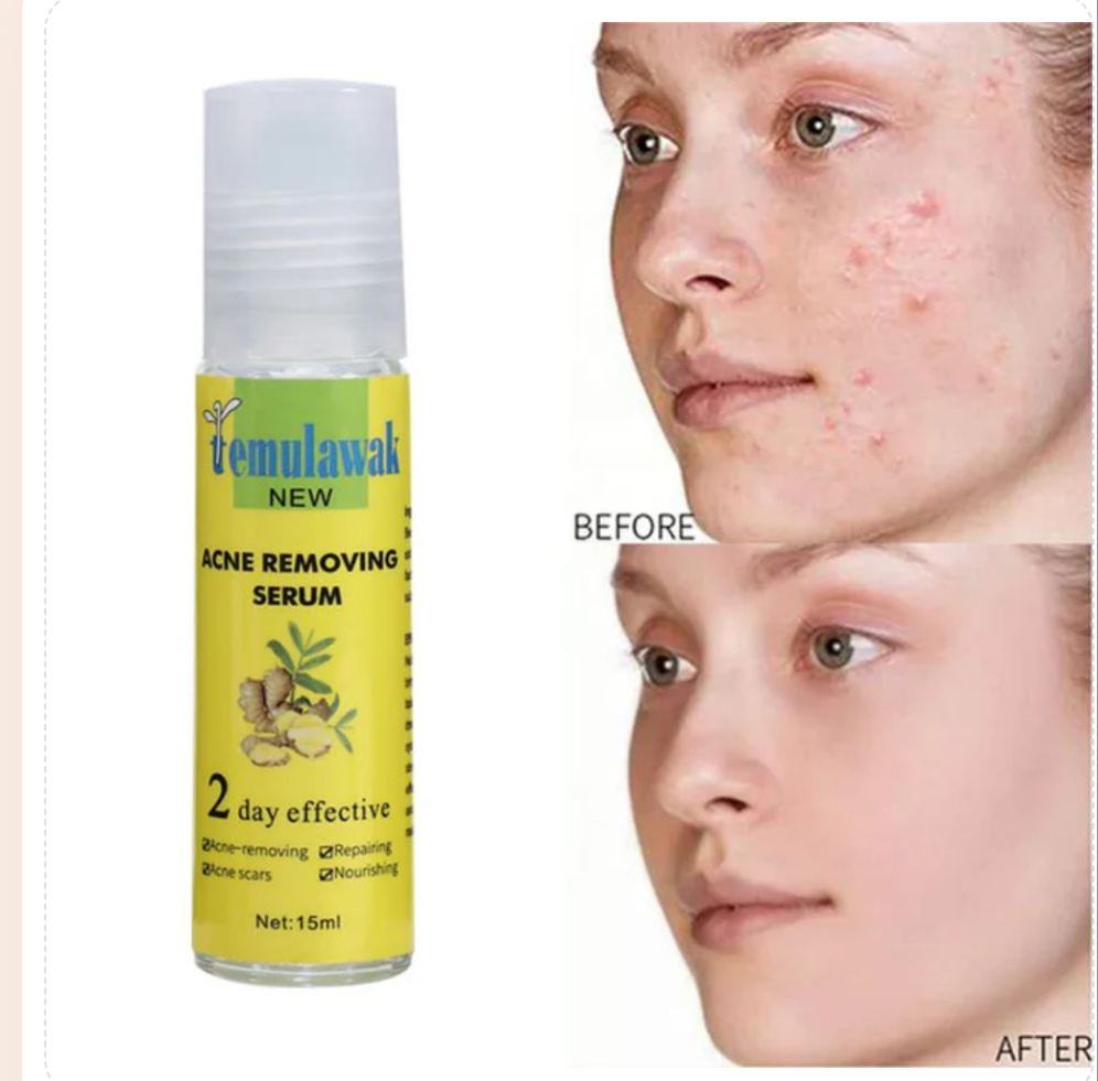 Temulawak - New Acne Removing Serum (Original)