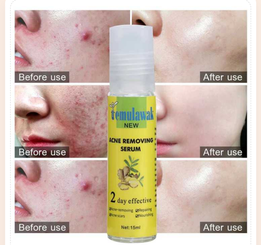 Temulawak - New Acne Removing Serum (Original)