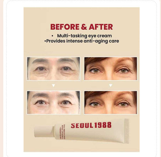 SEOUL 1988 Eye Cream